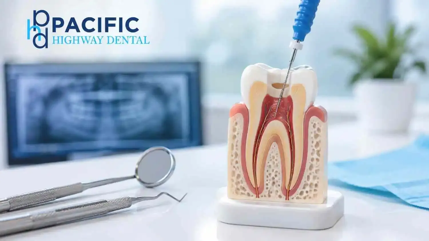 Tooth Pain That Won’t Go Away? Understanding Root Canal Treatment